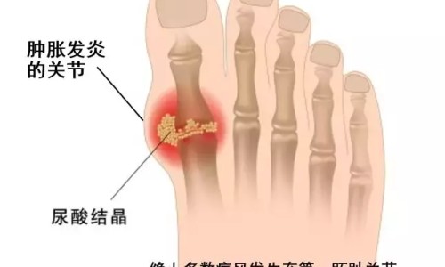 盐酸二氧丙嗪颗粒成人可以-盐酸二氧丙嗪颗粒成人网- 盐酸二氧丙嗪颗粒成人用量是多少知识,分享盐酸二氧丙嗪颗粒成人用量